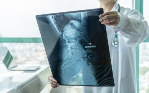 Symptoms of a Broken Neck