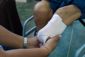 Why Choose Benton Accident & Injury Lawyers for Help After an Amputation Injury in Dallas, TX?